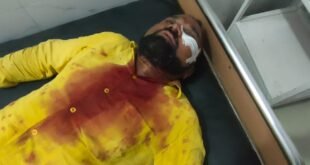 चन्दौली-: डेयरी व्यवसायी व पत्रकार से दिनदहाड़े दो लाख की लूट, बुलेट सवार बदमाशों ने असलहे के बट से सिर पर किया बार।