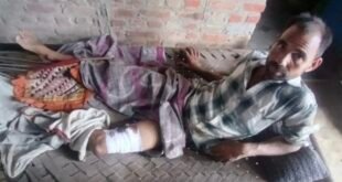 खेत पर गए किसान पर जंगली सूअर का हमला, भाकियू (जनशक्ति) ने मुआवजे और सुरक्षा की उठाई मांग। 