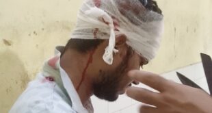 गंगा एक्सप्रेसवे पर ट्रक और पिकअप की जोरदार भिड़ंत, पिकअप चालक गंभीर रूप से घायल।